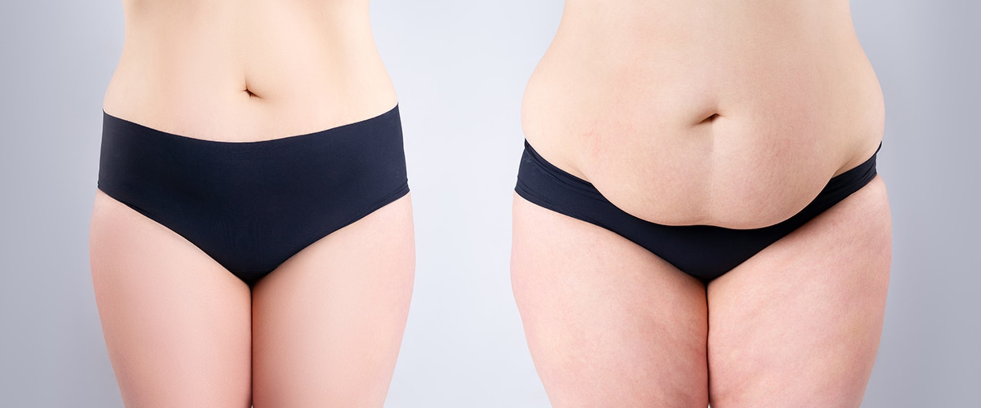 The Impact of Tummy Tuck Procedures on Patient Satisfaction