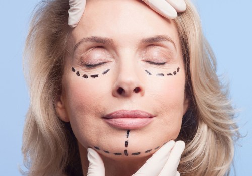 The Ultimate Guide to Cosmetic Surgery: What You Need to Know