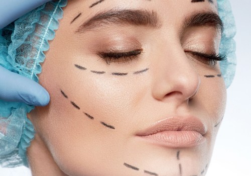 The Ultimate Guide to Plastic Surgery: From an Expert's Perspective